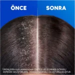 خرید و قیمت شامپو مو هد اند شولدرز لیمون فره‌لئی (لیمویی) Head & Shoulders Lemon Ferahlığı حجم 330 میلی لیتر