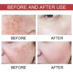 سرم ضد لک نیاسینامید %۱۰ + ترانگزامیک اسید ۴ آنوا Anua Niacinamide 10% + TXA ۴% Dark Spot Correcting Serum حجم 30 میلی لیتر - Image 11