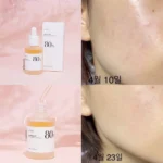 خرید و قیمت آمپول تسکین دهنده و مرطوب کننده حاوی عصاره هوتونیا کوردتا آنوا Anua Heartleaf ۸۰% Moisture Soothing Ampoule ۳۰ml حجم 30 میلی لیتر