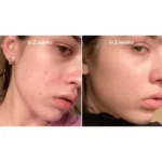 سرم ضد لک نیاسینامید %۱۰ + ترانگزامیک اسید ۴ آنوا Anua Niacinamide 10% + TXA ۴% Dark Spot Correcting Serum حجم 30 میلی لیتر - Image 13