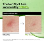 سرم آزلائیک اسید %۱۰ و هیالورون تسکین دهنده آنوا Anua Azelaic Acid 10 Hyaluron Redness Soothing Serum حجم 30 میلی لیتر - Image 9
