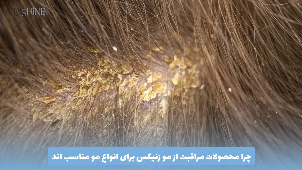 چرا محصولات مراقبت از مو زنیکس برای انواع مو مناسب‌ اند 