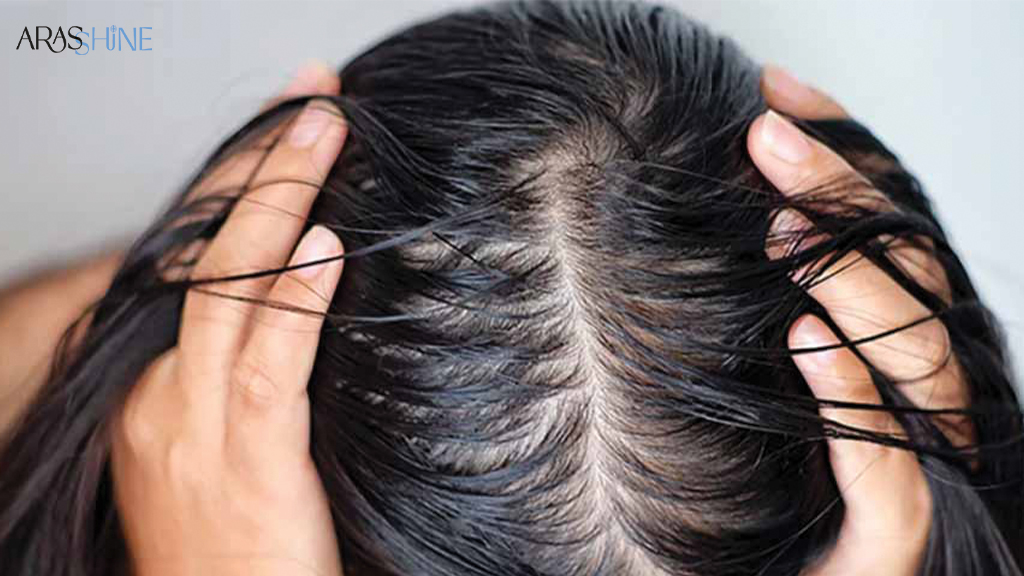 آیا موهای چرب را باید هر روز شست؟
