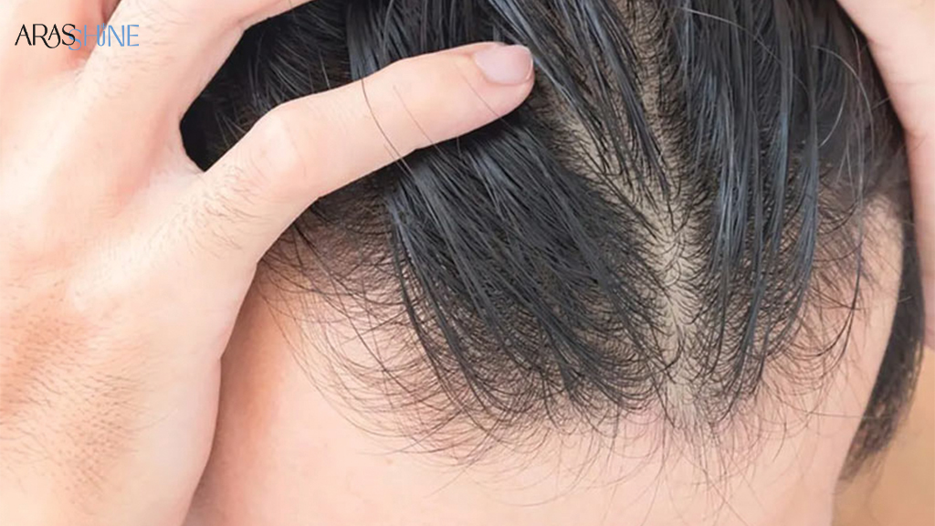 برای موهای نازک و شکننده چه باید کرد؟